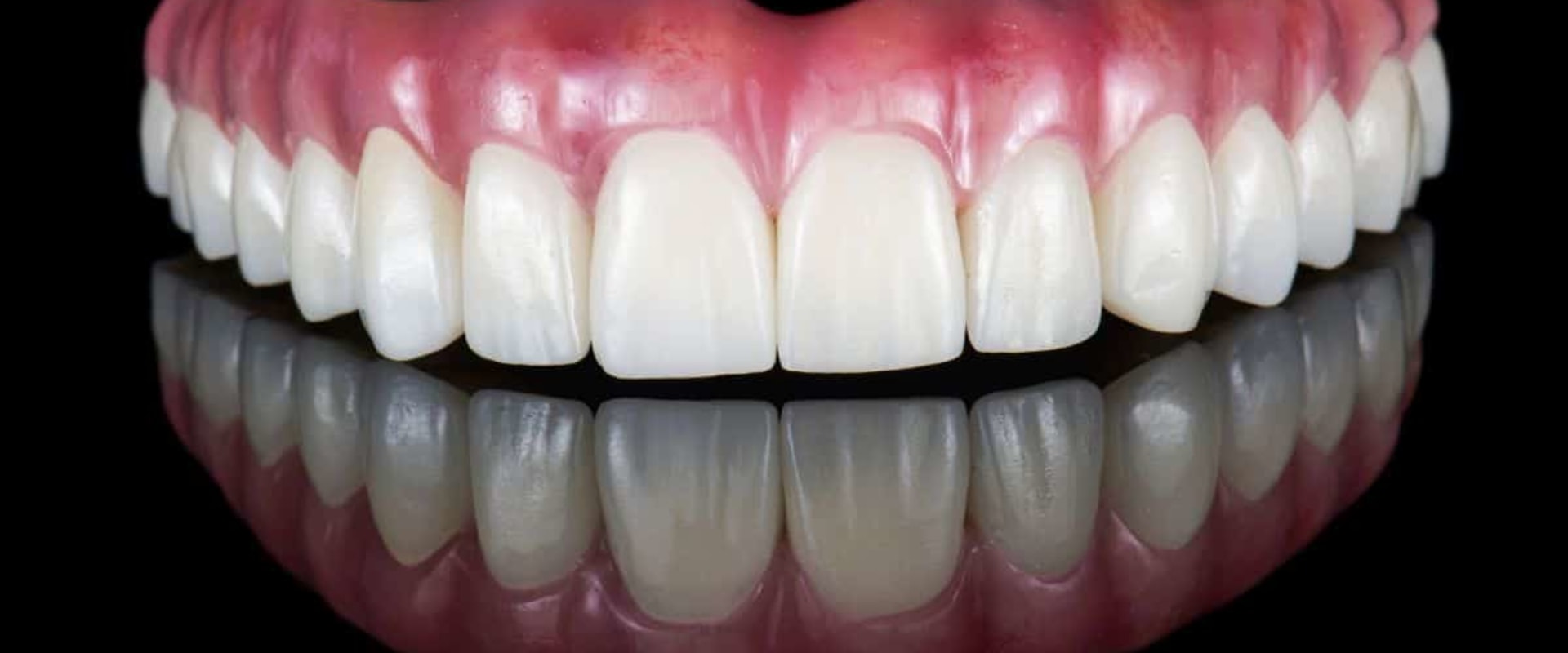 How often does the body reject a dental implant?