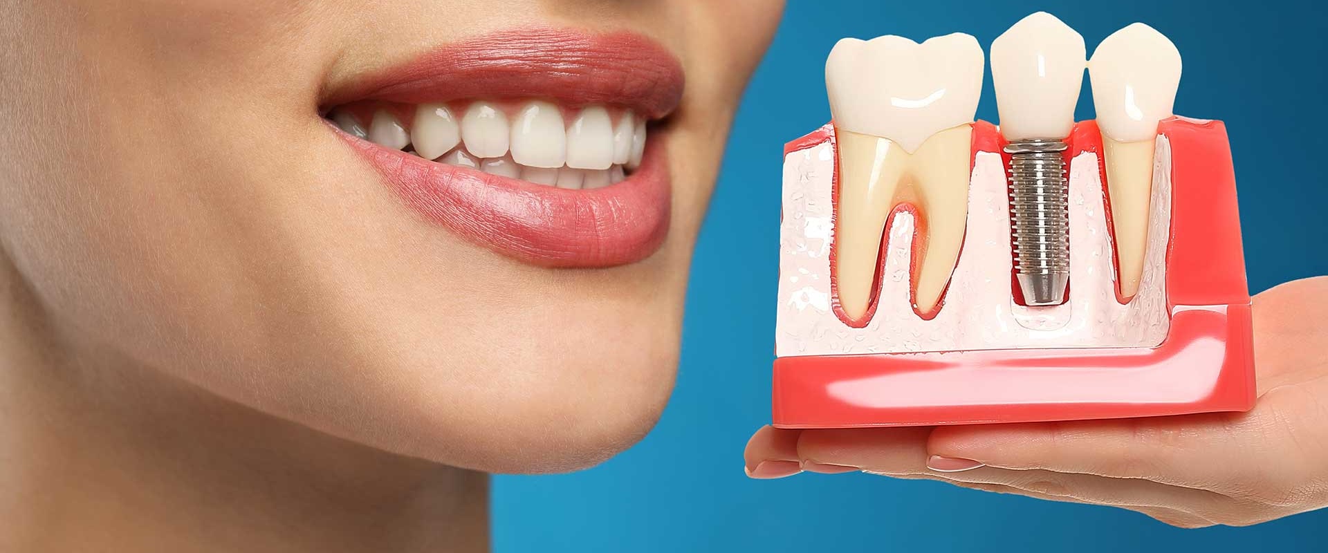 What are the negatives of dental implants?