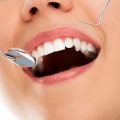 Understanding Dental Implants: A Comprehensive Guide to Comparison with Other Options
