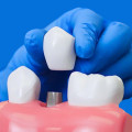 Do dental implants feel strange at first?