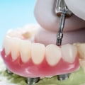 What is the biggest reason implants fail?