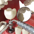 What is the best age to get dental implants?