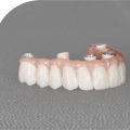 How can a dentist tell if an implant is failing?