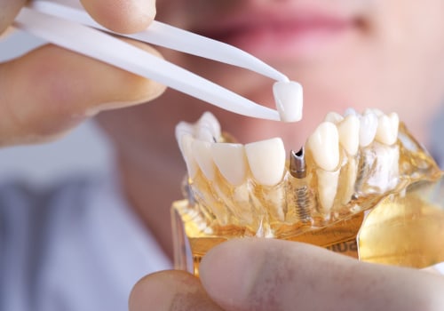 What is the number one reason for dental implant failure?