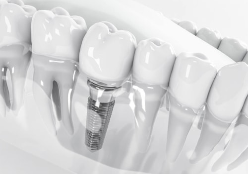 What is the most common complication of dental implants?