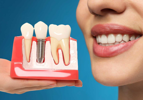 What are the negatives of dental implants?